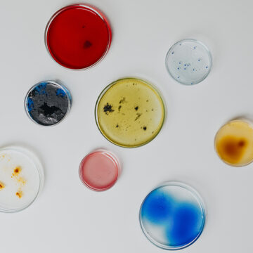 Robot e batteri salvano le opere d’arte