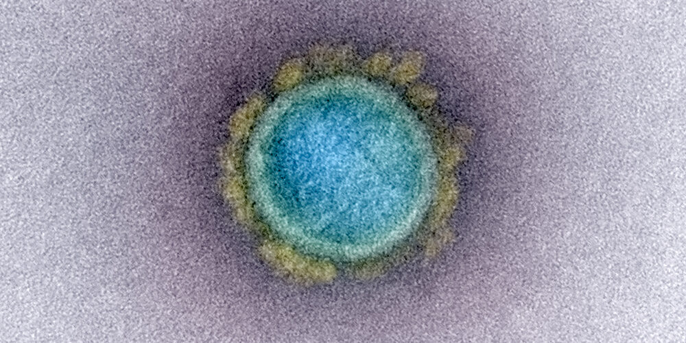 Verso la prossima pandemia