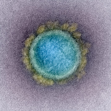 Verso la prossima pandemia