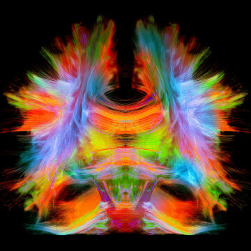 Human Brain Project: il futuro della mente è digitale?