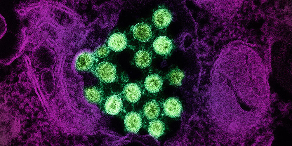 Siamo pronti alla prossima pandemia?