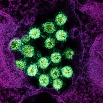 Siamo pronti alla prossima pandemia?