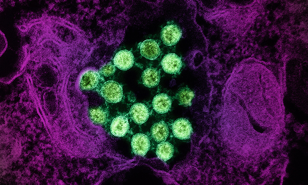 Siamo pronti alla prossima pandemia?